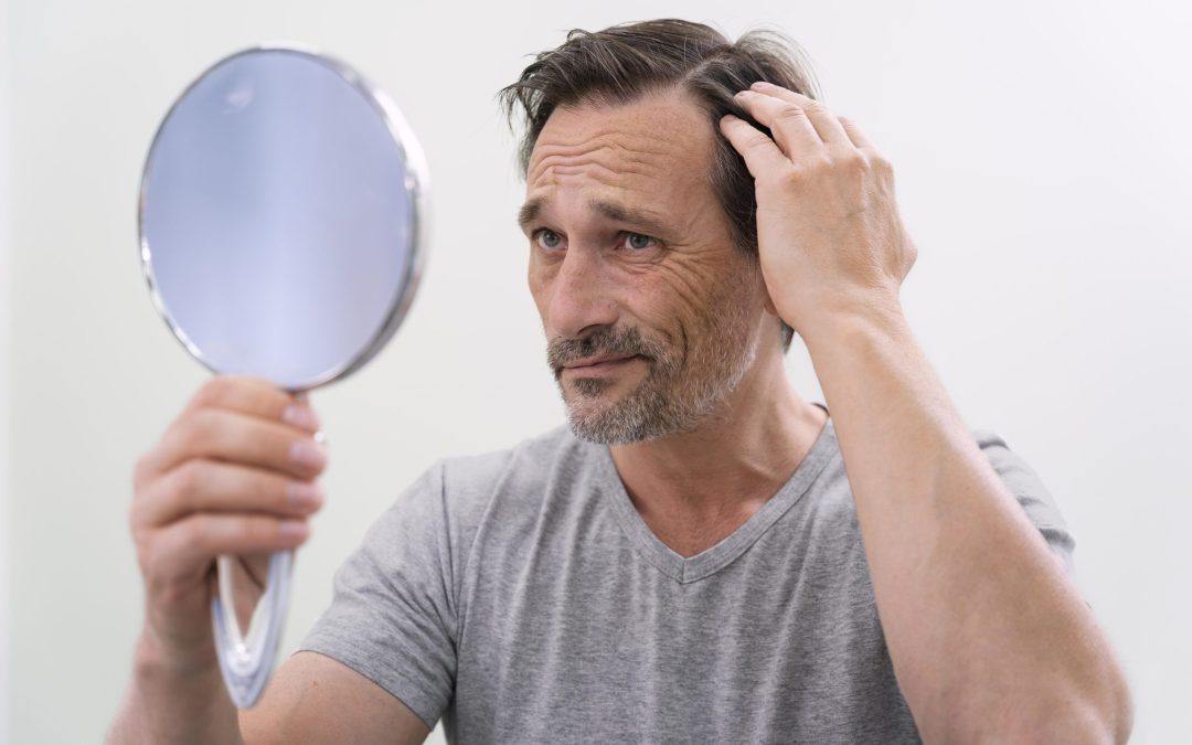Understanding Hair Loss: Causes, Prevention, and Effective Treatments