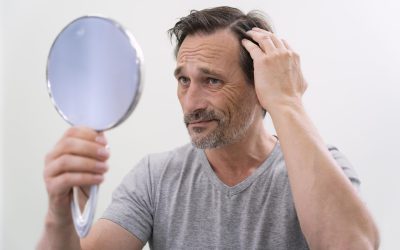 Understanding Hair Loss: Causes, Prevention, and Effective Treatments