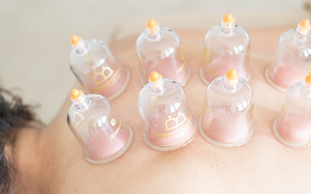 Cupping Therapy: Accelerate Healing in Sports Injuries