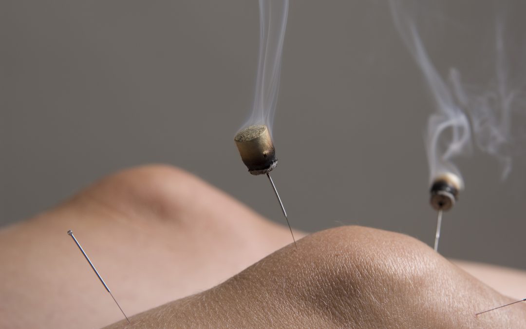 Acupuncture and Moxibustion for Knee Osteoarthritis: A Traditional Chinese Medicine Perspective
